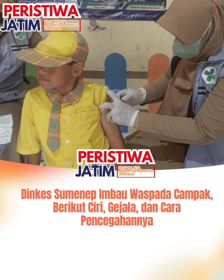 Dinkes Sumenep Imbau Waspada Campak, Berikut Ciri, Gejala, dan Cara Pencegahannya